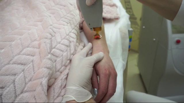 Лазерная эпиляция смотреть онлайн