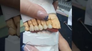 Изготовление циркониевых коронок в артикуляторе