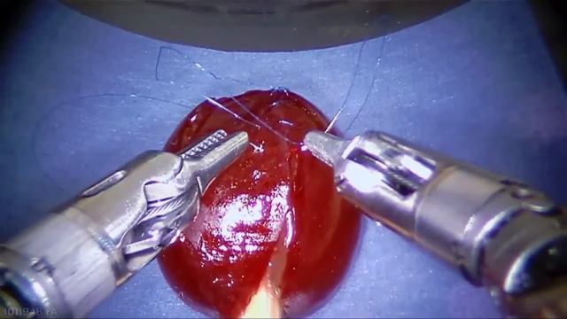 Incredible Robot Stitches A Grape Back Together! Робот зашивает вишню