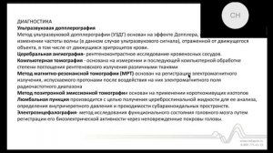 Инсульт - острое нарушение мозгового кровообращения