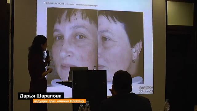 BBL - лечение мелазмы и сосудистых изменений всего за 2 процедуры смотреть онлайн