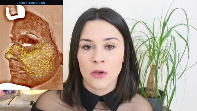 Mon expérience au DERMA CENTER - Cyrielle смотреть онлайн
