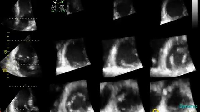 12slice 3D reconstruction смотреть онлайн