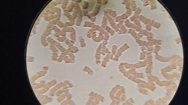 Состояние крови после САЛА с хлебом смотреть онлайн