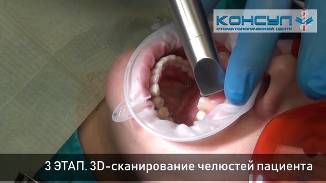 CAD/CAM-протезирование смотреть онлайн