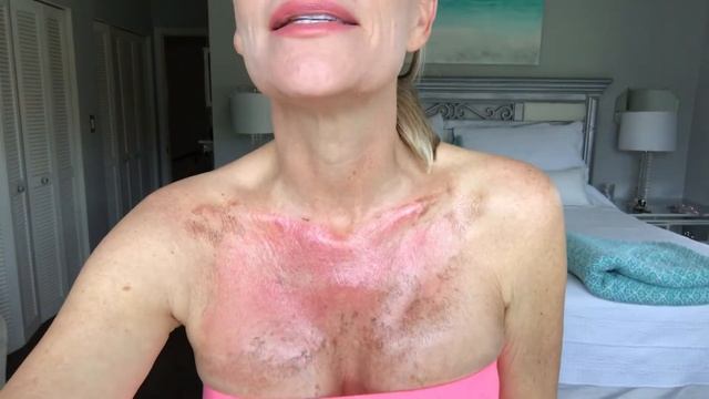 TCA 35% peel смотреть онлайн