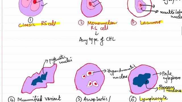 Hodgkin Lymphoma for 2nd Year MBBS | Pathology | Lectures by Omer смотреть онлайн
