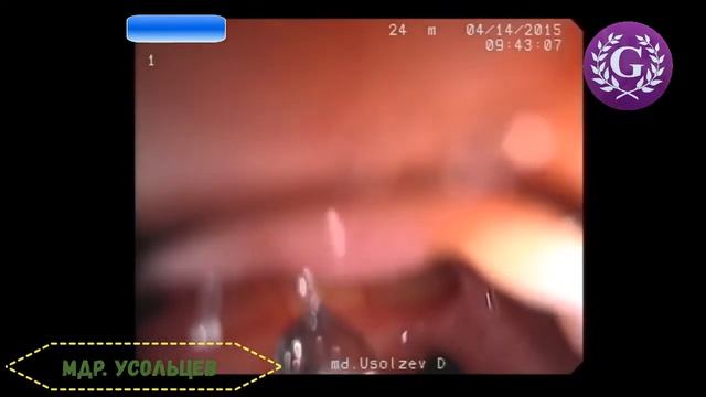 Рыбья кость смотреть онлайн