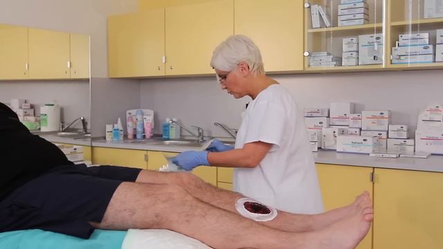 Aplikace krytí Hydrosorb Gel смотреть онлайн