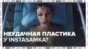 Неудачная пластика у Instasamka? — Москва24|Контент