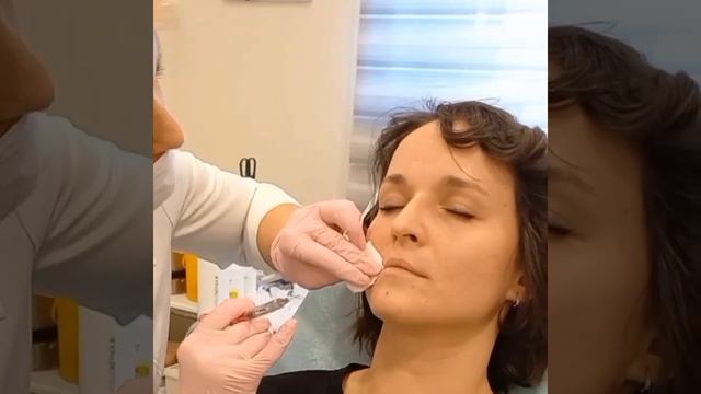Контурная пластика губ смотреть онлайн
