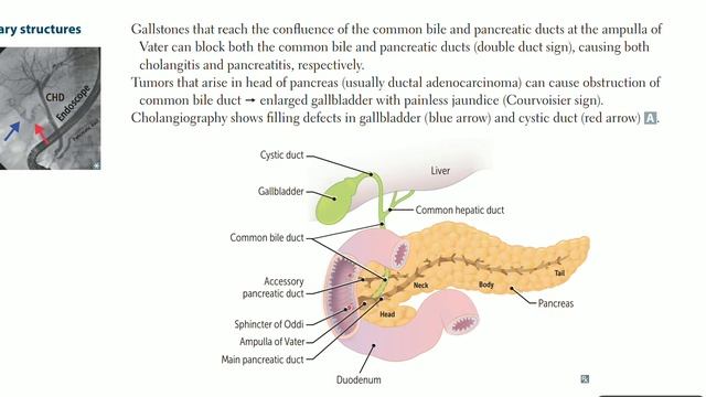 Up To Date - GIT anatomy (part 8) [biliary tree] смотреть онлайн