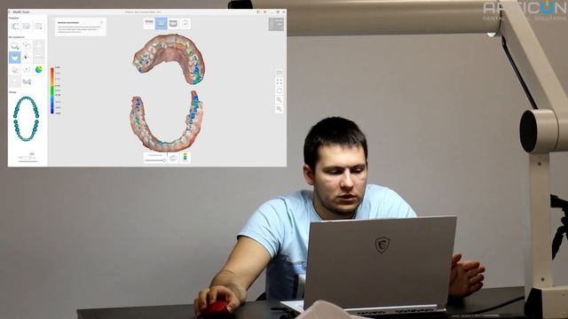 Medit i500 - Как пересопоставить сканы в окклюзии не пересканируя?