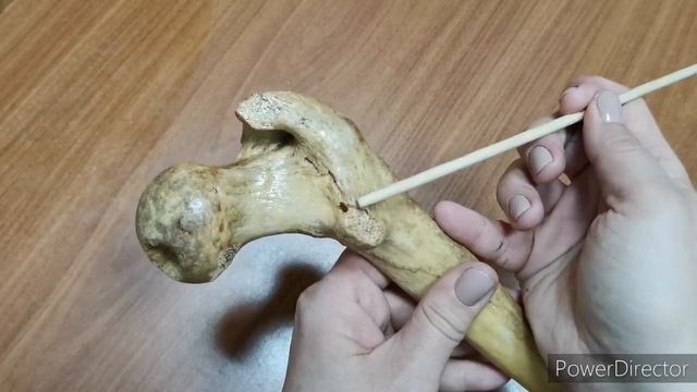 Бедренная кость смотреть онлайн