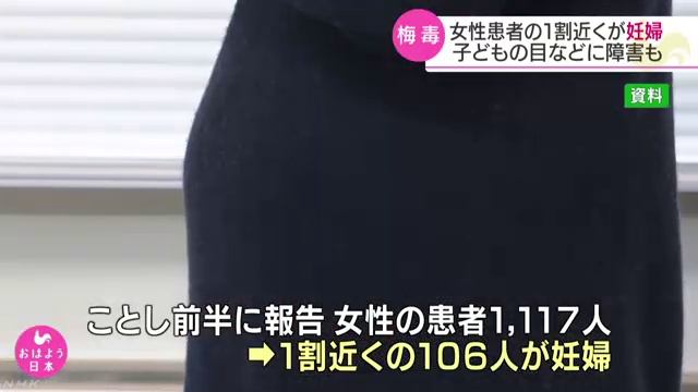 女性の梅毒患者 1割近くが妊婦 初の実態報告 国立感染症研究所 смотреть онлайн