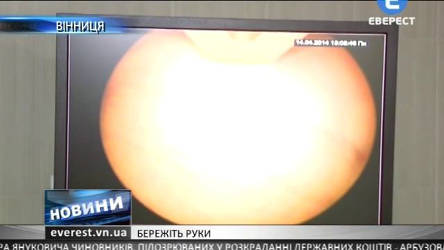 Бережіть руки смотреть онлайн