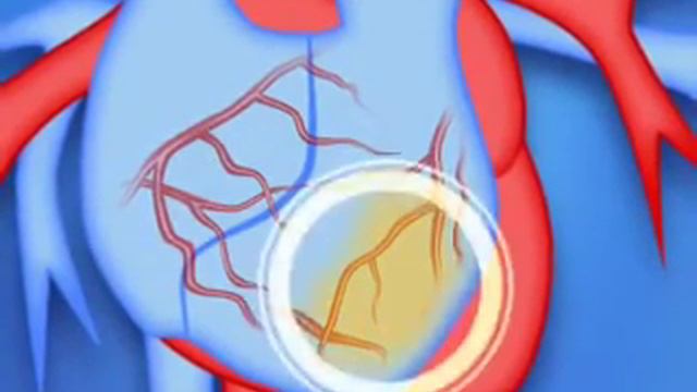 5  Коэнзим Q10  Кудесан Xvid