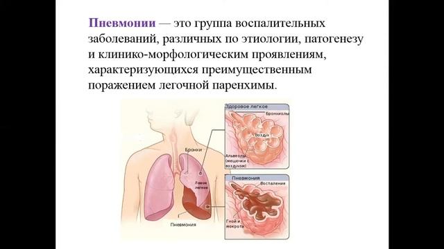 Эштаева Г.К. Патология дыхательной системы (часть 1) смотреть онлайн