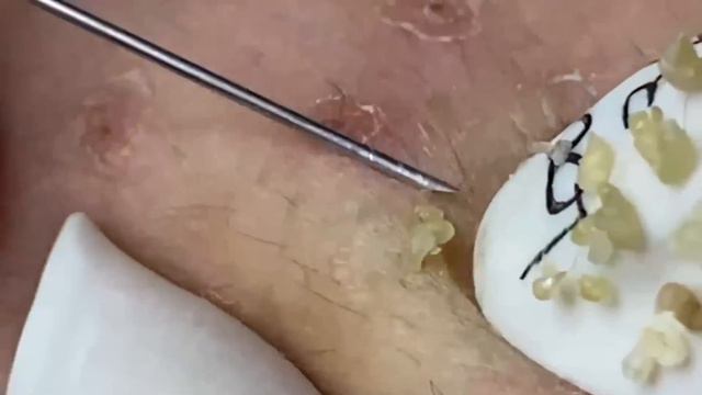 Enjoy Your Day With Hien Nguyen Spa # 1164 смотреть онлайн