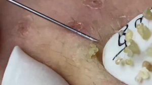 Enjoy Your Day With Hien Nguyen Spa # 1164