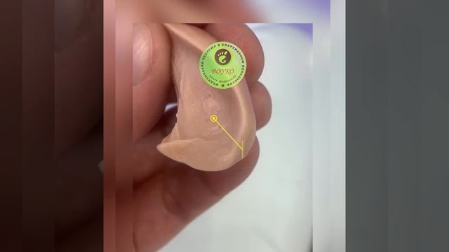 Мозоль ? между пальцев ?? смотреть онлайн