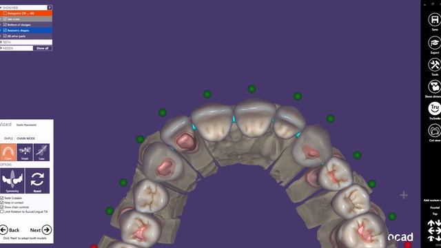 exocad Quick Guide: The "Chain Mode" Feature смотреть онлайн