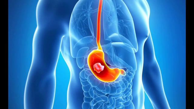 TUYA SUTI QANDAY KASALLIKLARDA DA'VO VA UNING O'ZGACHA JIHATLARI смотреть онлайн