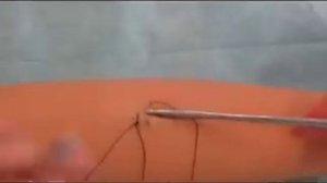 Техника наложения шва Мультановского