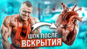СЕРДЦЕ РАЗМЕРОМ С ФУТБОЛЬНЫЙ МЯЧ. ЗАГАДОЧНАЯ СМЕРТЬ ДАЛЛАСА МАККАРВЕРА