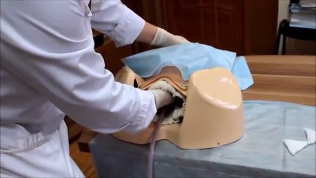 Ручное отделение плаценты смотреть онлайн