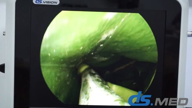 Эндоскопическая видеосистема DS.Vision SD 3in1
