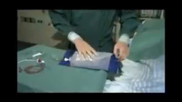 Как подготовить пациента к мониторингу смотреть онлайн