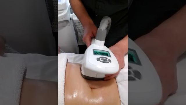 курс процедур на новом аппарате V-Shape смотреть онлайн