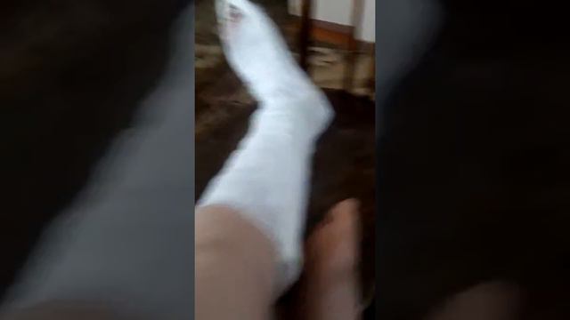 Мне налажили ГИПС,ГИПС. История в следующем видео!! Капец просто!!!) смотреть онлайн