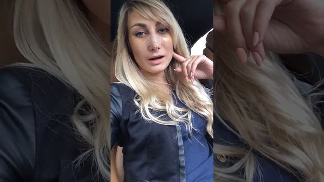 Ринопластика!Реабилитация!24 день после рино смотреть онлайн