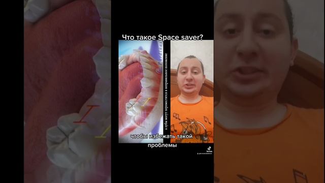 Что такое Space saver? #стоматология #стоматолог #spacesaver #детскийстоматолог #детскаястоматологи смотреть онлайн
