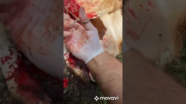 Актиномикоз двухсторонний