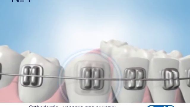 Разница между насадками для электрических зубных щеток Oral-B смотреть онлайн