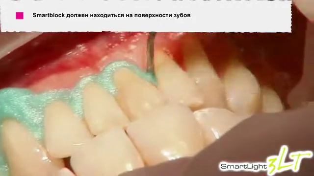 SmartLight3LT Инструкция на русском языке