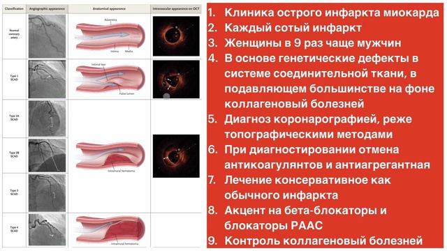 Спонтанное расслоение коронарной артерии смотреть онлайн