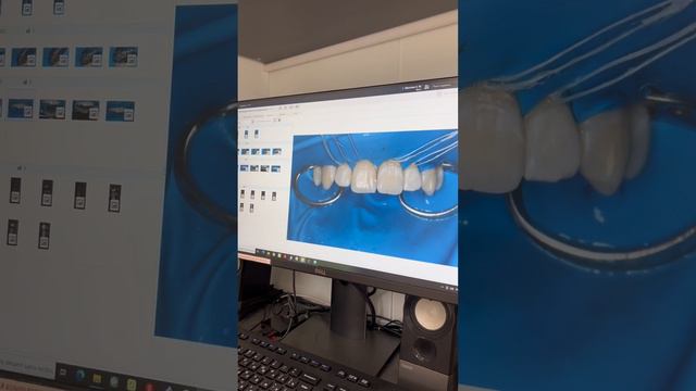 Кейс детского стоматолога стоматологической клиники Dentalogica. Вторая часть. смотреть онлайн