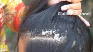 Hair Combing Dandruff / Cialina Channel 1136