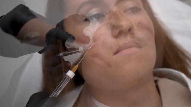 ЭКСПРЕСС ФЕЙСЛИФТИНГ