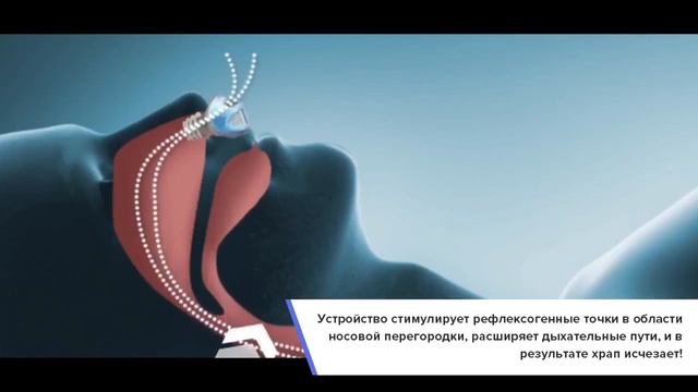 Клипса от храпа Snorest купить в Москве смотреть онлайн