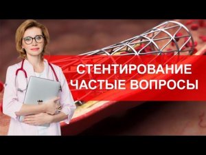 Стентирование. Частые вопросы. Кардиолог. Москва