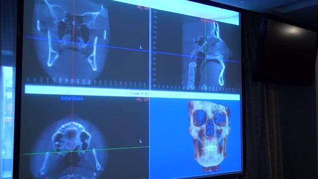 3D-цефалометрия: новый уровень диагностики в ортодонтии смотреть онлайн