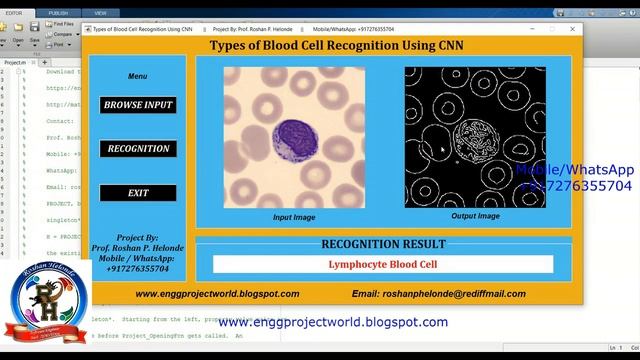 Blood Cell Type Recognition Using CNN Matlab Project With Source Code | Blood Cell Identification смотреть онлайн