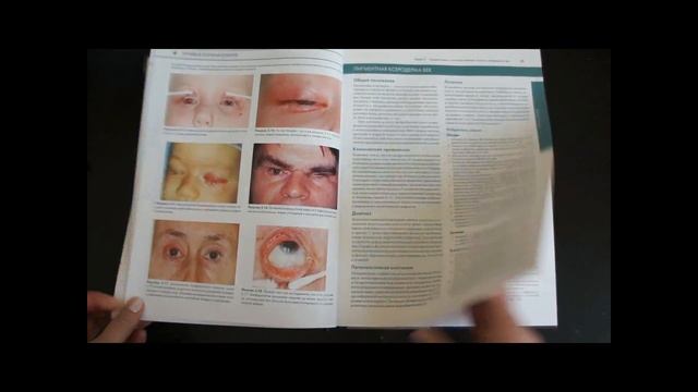 Опухоли век, конъюнктивы и глазницы смотреть онлайн