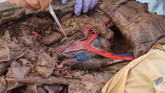 Вегетативная нервная система. ລະບົບປະສາດອັດຕະໂນມັດ смотреть онлайн