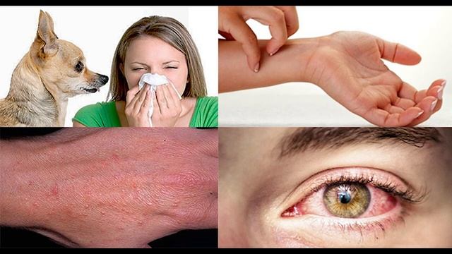 Аллергия на собак. Типичные заблуждения. Что делать? смотреть онлайн